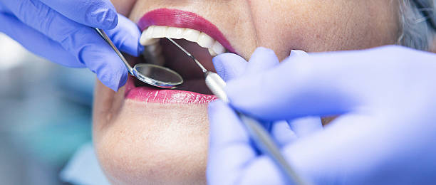 Best Emergency Dental Care for Broken or Chipped Teeth in Marlene Village, OR